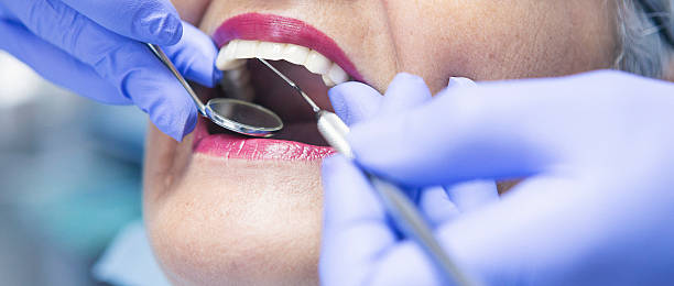Best Emergency Broken Tooth Repair in Pine Valley, CA